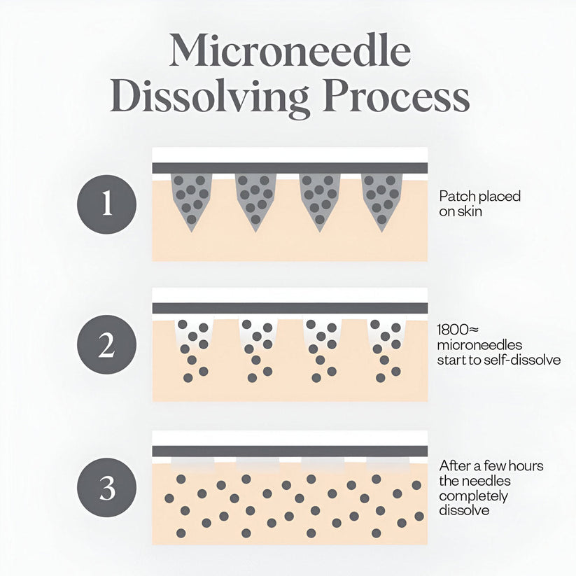 Skinwise™ Micro needle Eye patches
